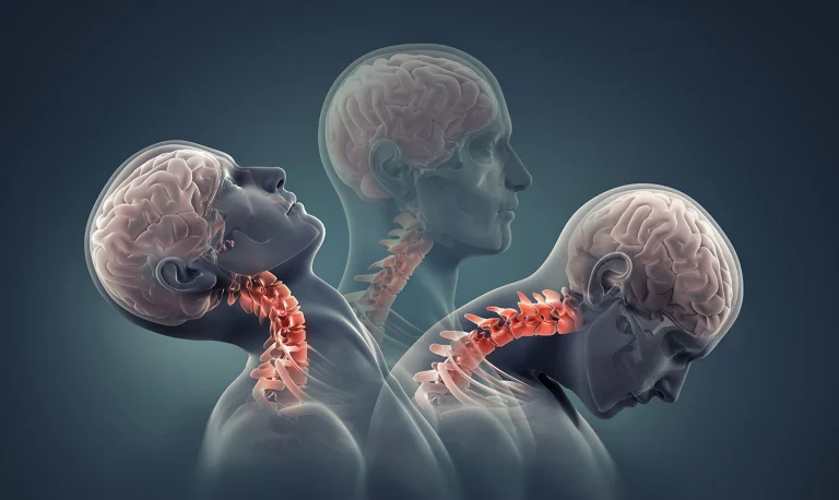 Desvendando a dor no pescoço: causas e tratamentos.